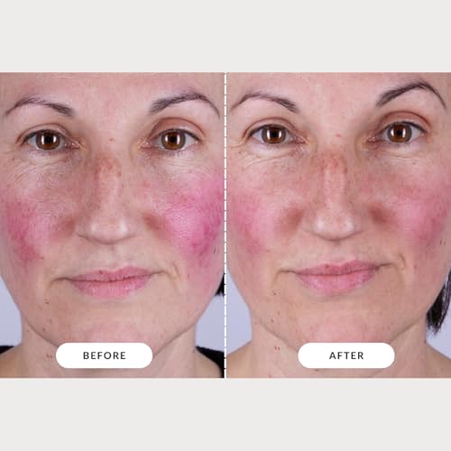 CurrentBody Skin LED Light Therapy Mask: Series 2