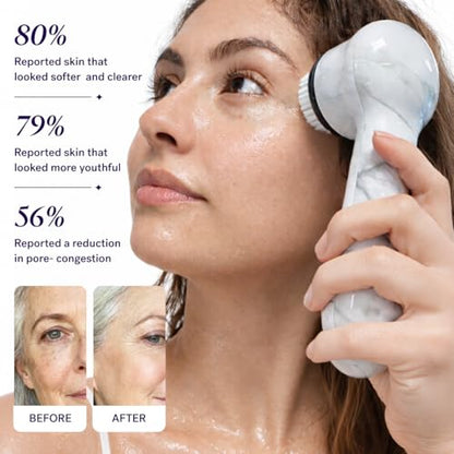 Michael Todd Beauty Soniclear Face Brush 2026 Allure Readers Choice Winner