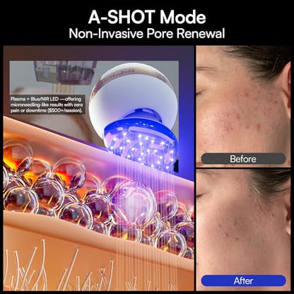INIA SPHERA Upgraded 8-in-1 Microcurrent Facial Device for Face & Neck