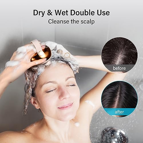 arboleaf Scalp Massager Head Massager Scalp