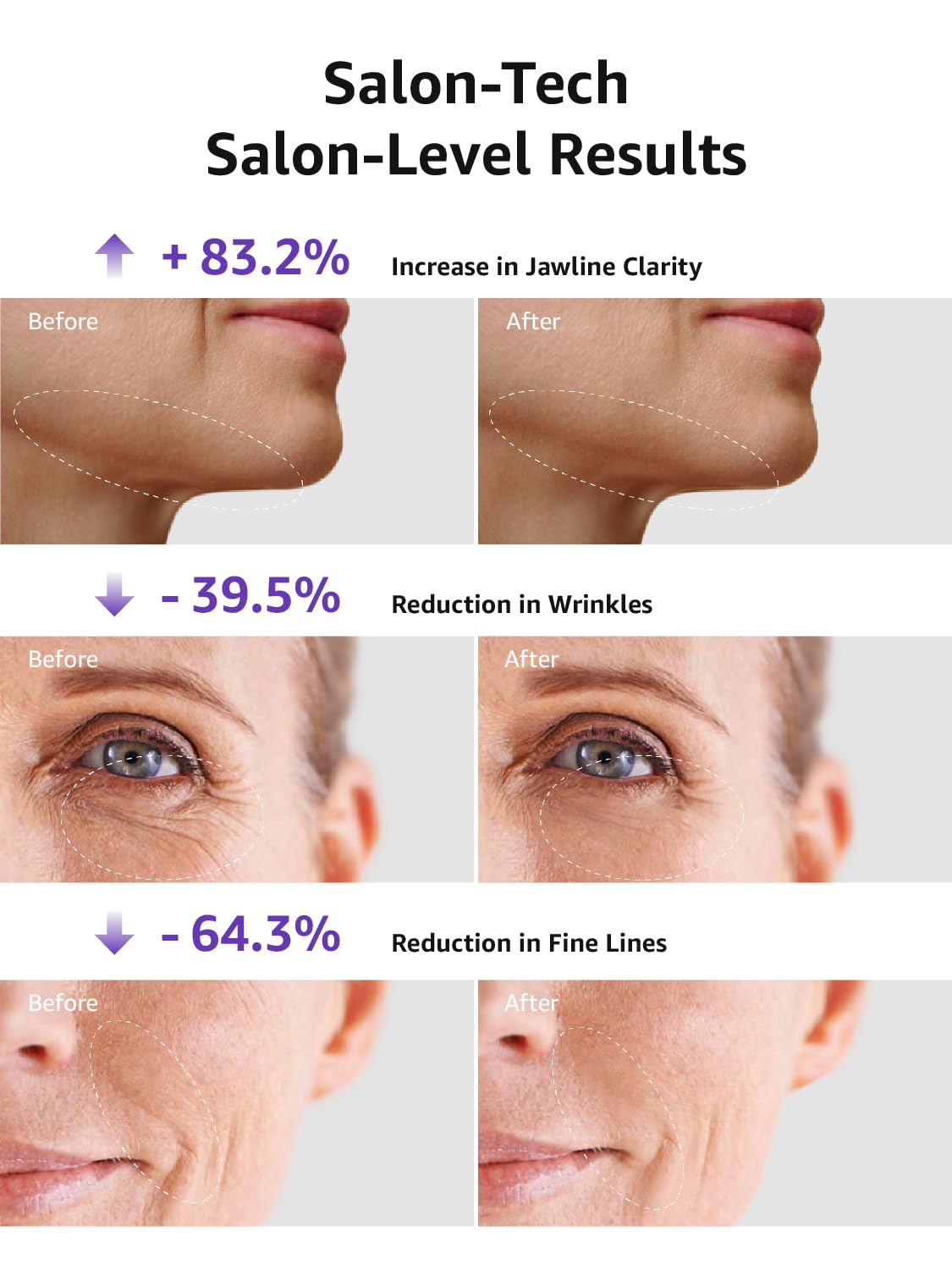 VITALY 3 in 1 Skin Tightening Device,Facial Massager