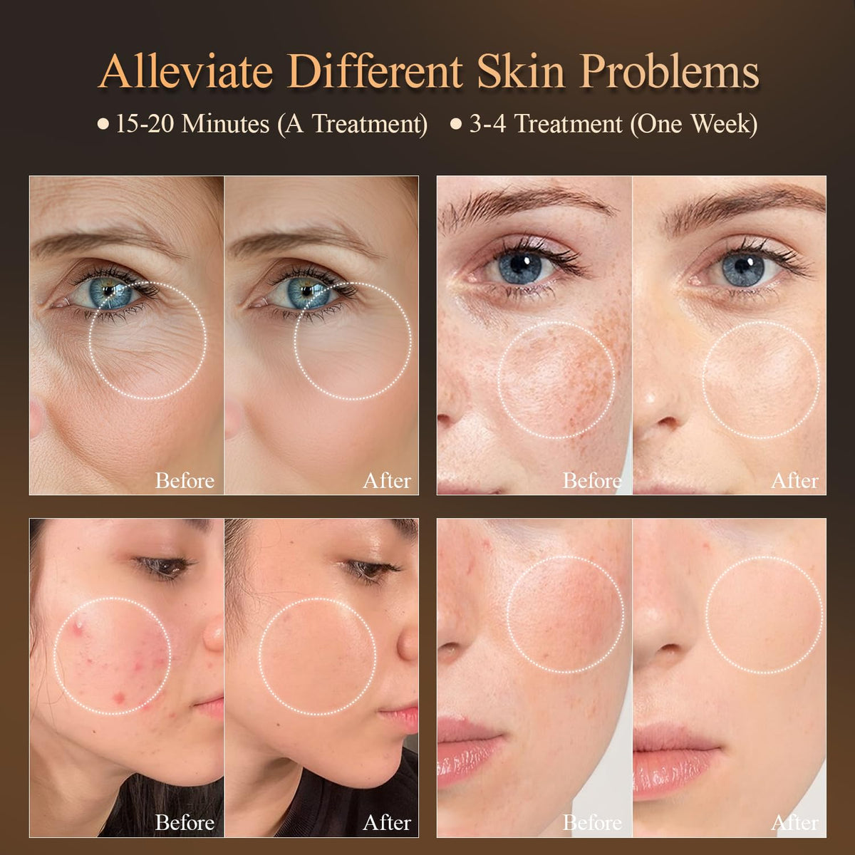 MEGELIN Face Mask