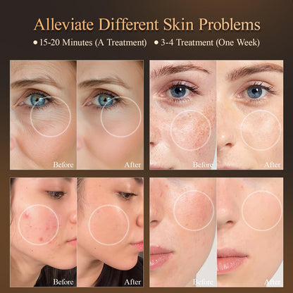 MEGELIN Face Mask