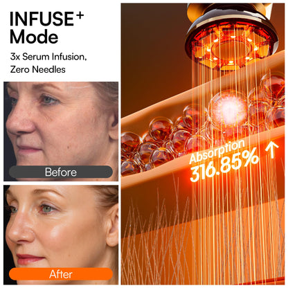 INIA Flare 3-in-1 Microcurrent Facial Device Red Light Therapy for Face